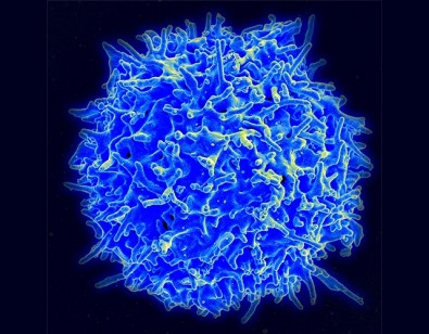 imagem feita por microscopia eletrônica de um linfócito T humano
