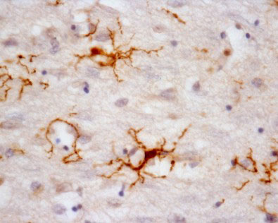 [microglia umana]